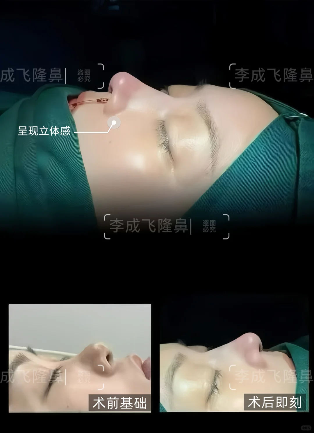 👃拉出面中丨呈现立体感