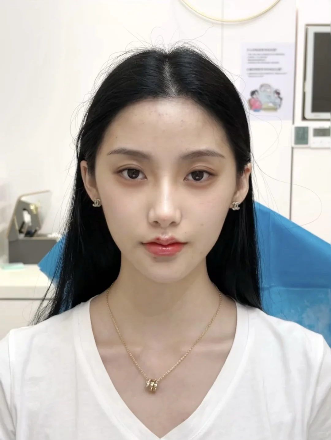 菱形脸do完太绝了！