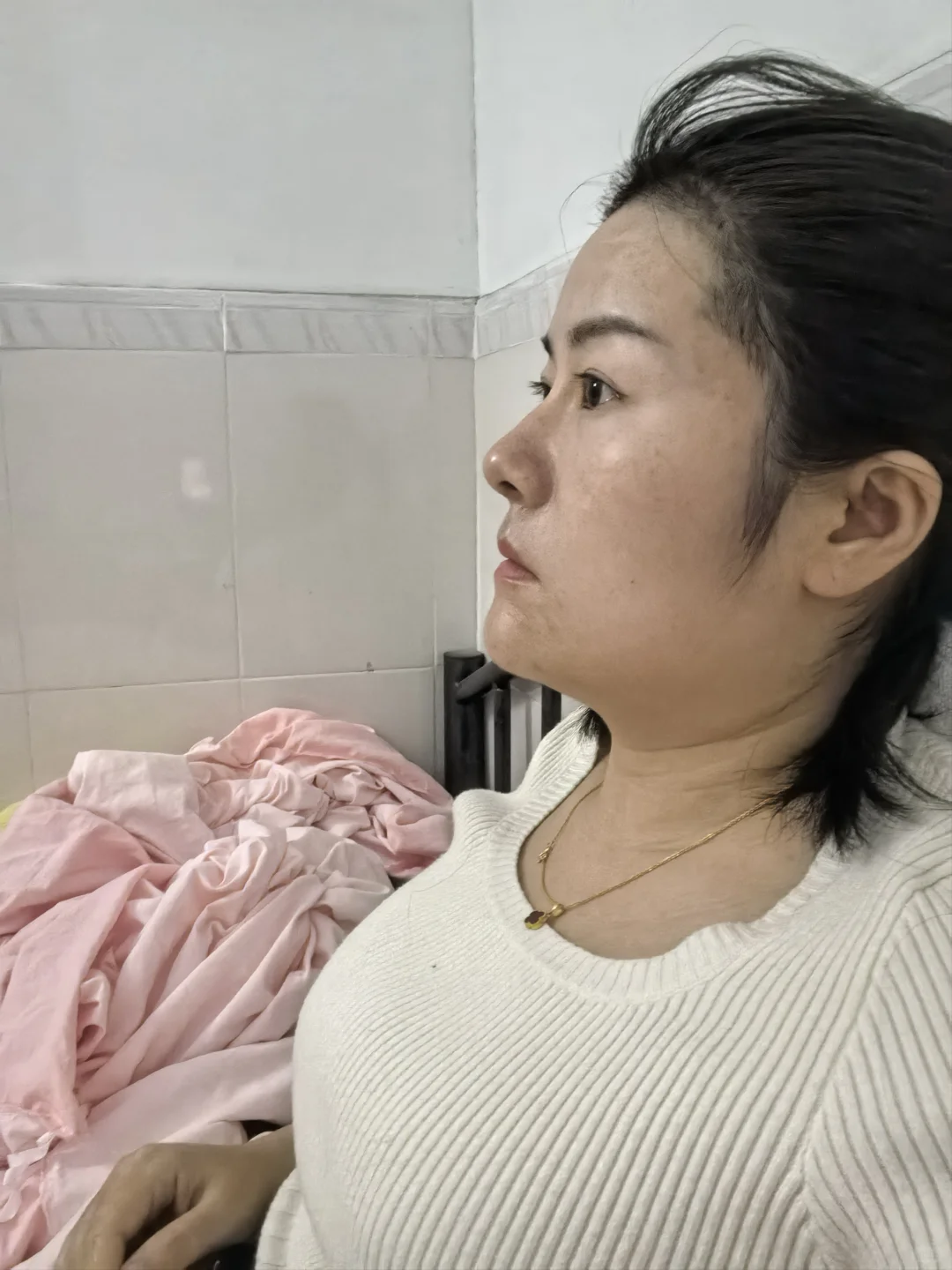 隆鼻原本甜妹系，现在显男相？