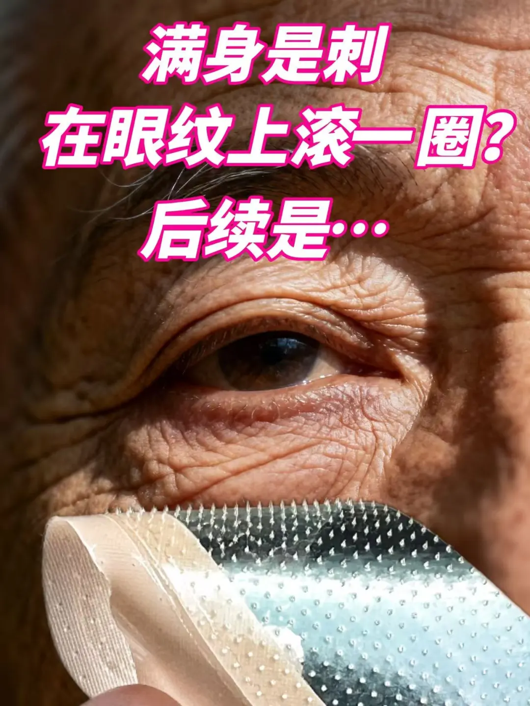 让这些刺在眼纹上滚一圈？