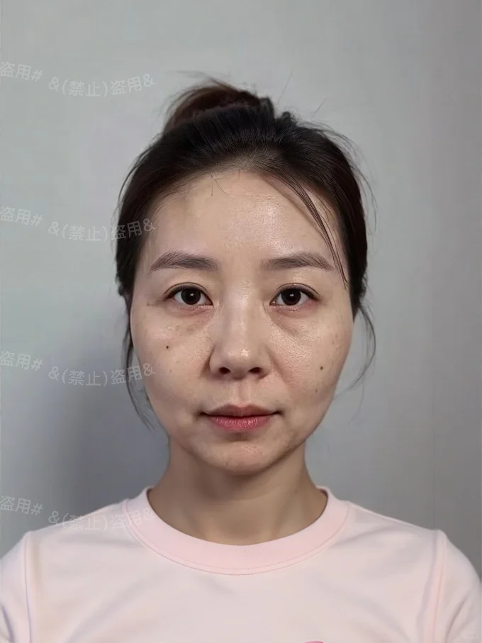 普女微调百分之30变化有多大？