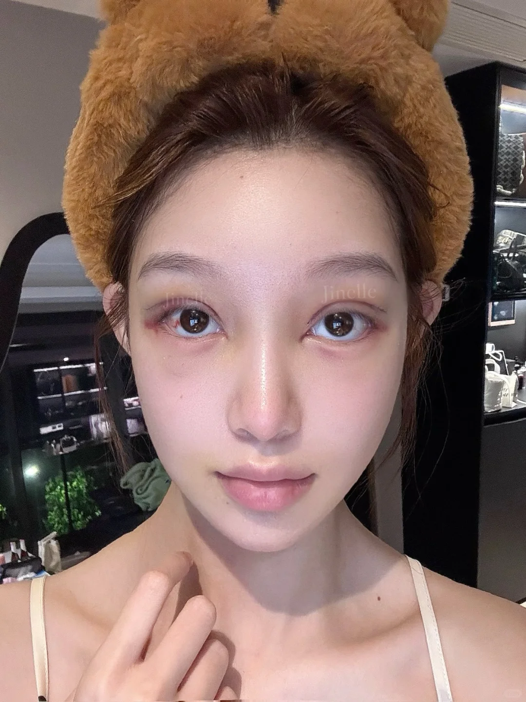 为什么修个👀鼻青脸肿