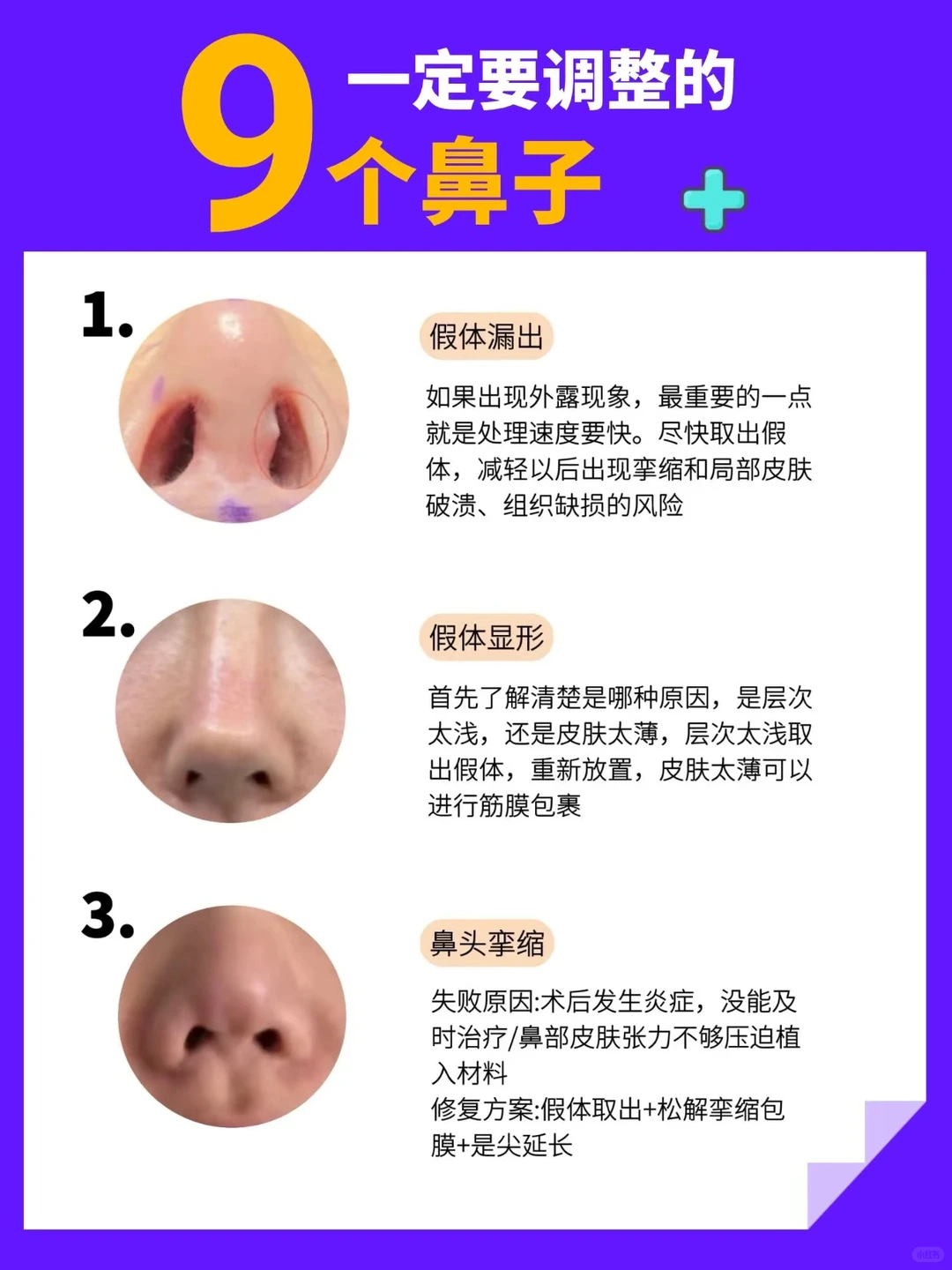 9个调整鼻型的方法