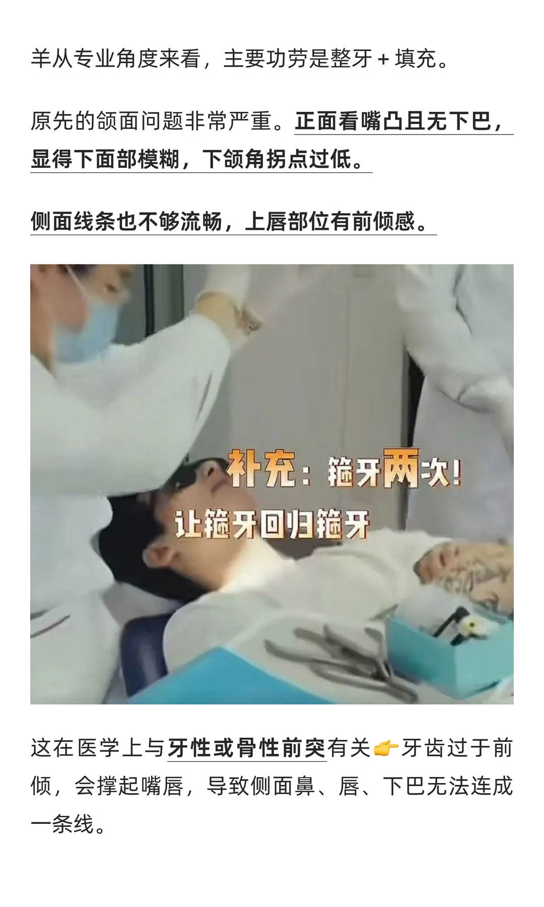 38w换头，支持男生都去卷颜值