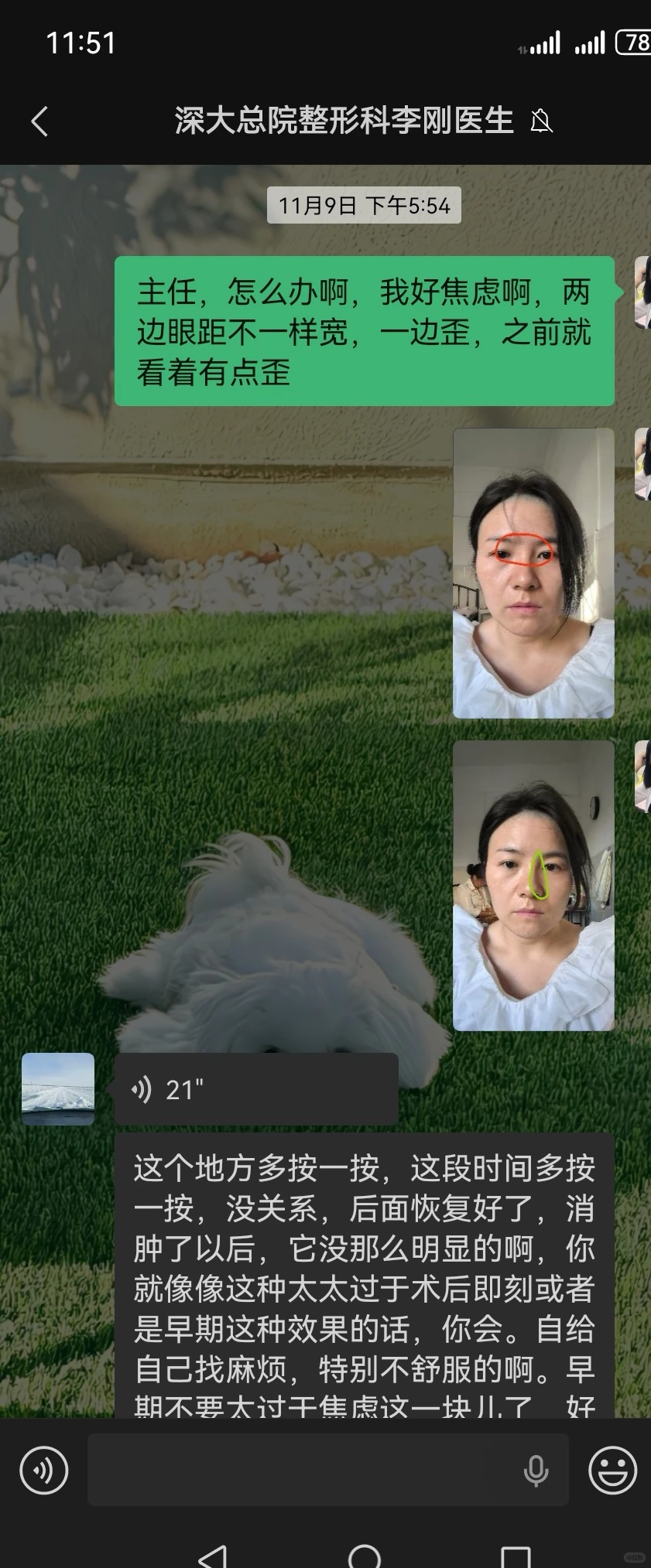 想到就生气，隆鼻