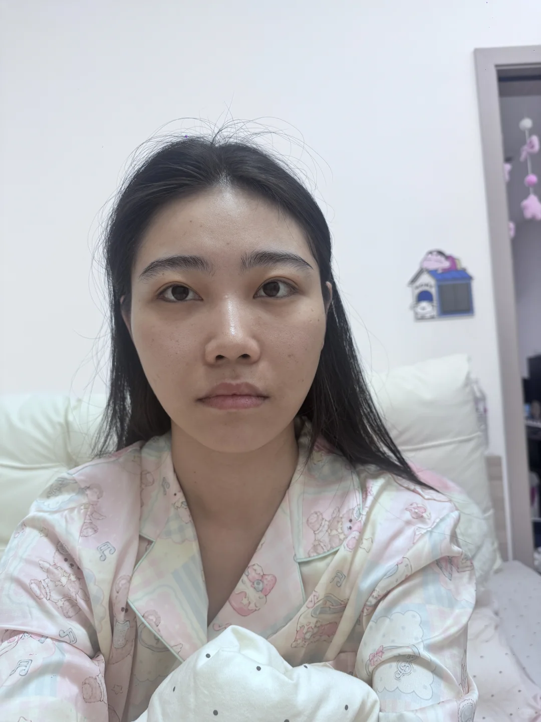 医美do脸对比照来喽