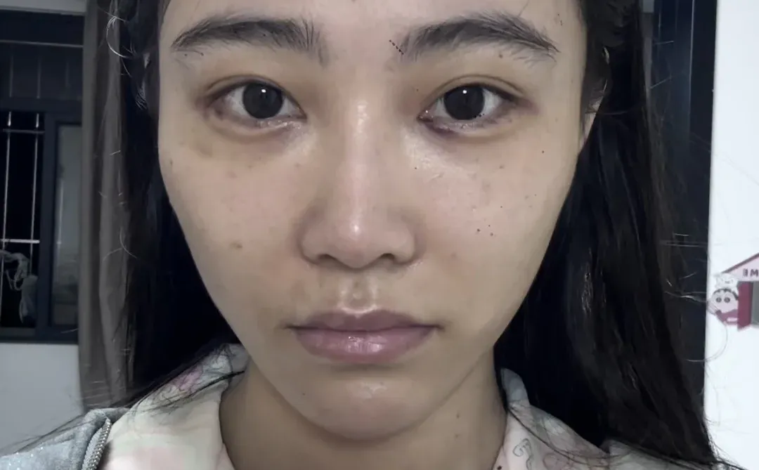 医美do脸对比照来喽