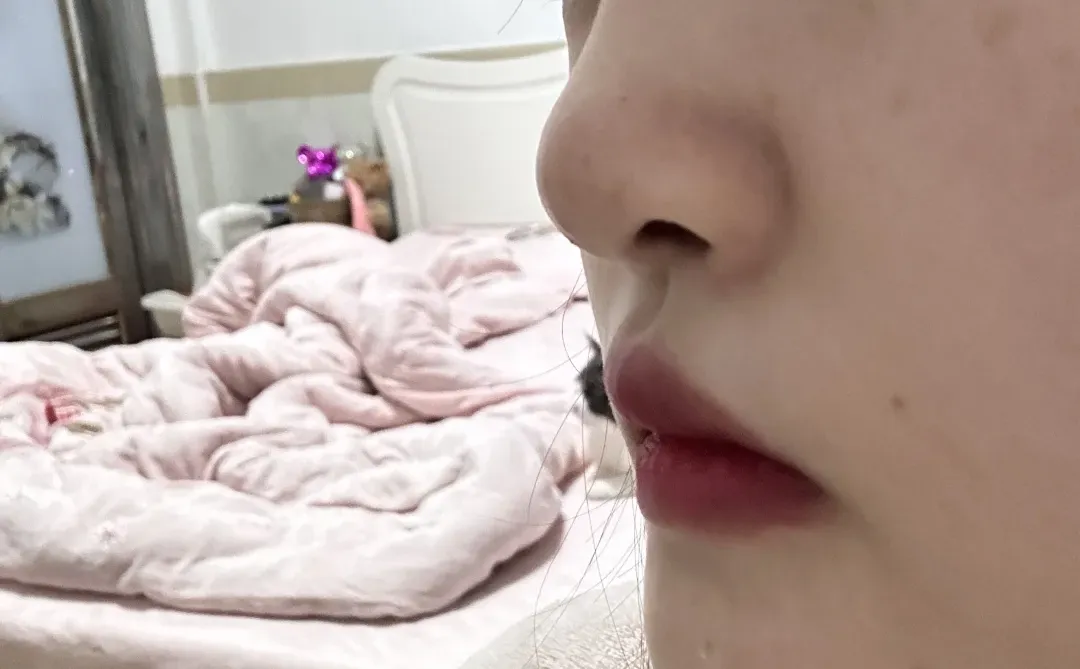 打鼻子👃第4天 我这算还行吧 无痛长个鼻子