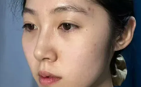 去试了打薄+提升（live版）