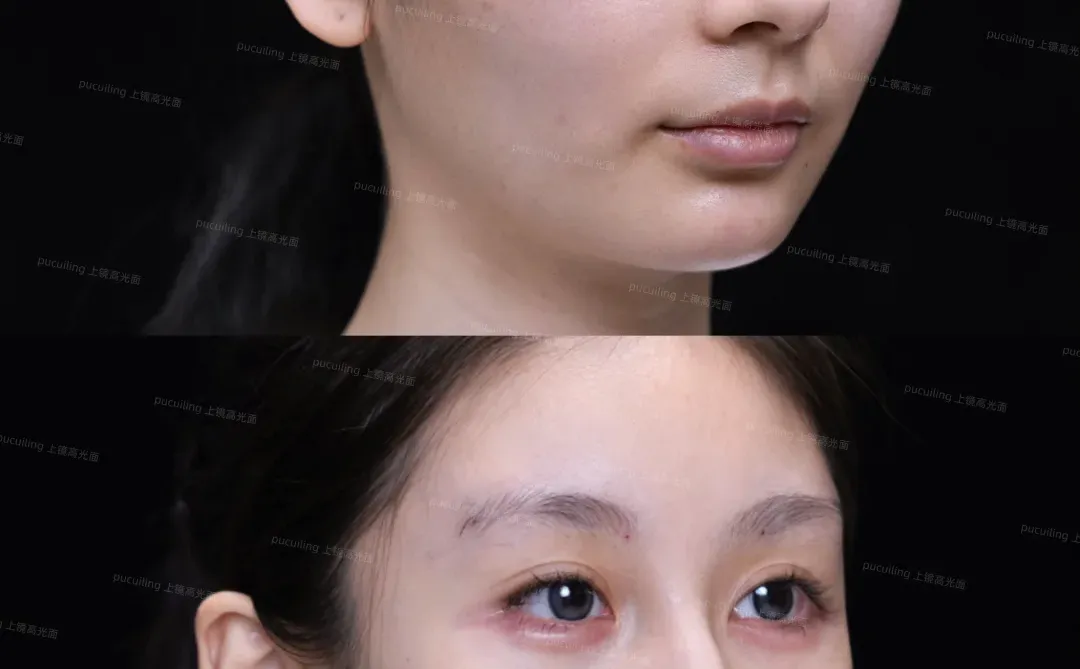 高颧骨+疲态脸|微调逆袭上镜脸