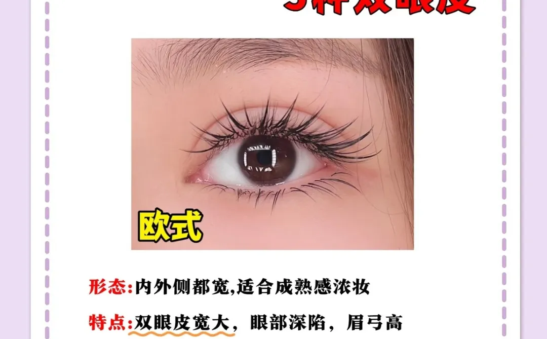 整形主任讲科普，5种双眼皮形态一次性说清楚