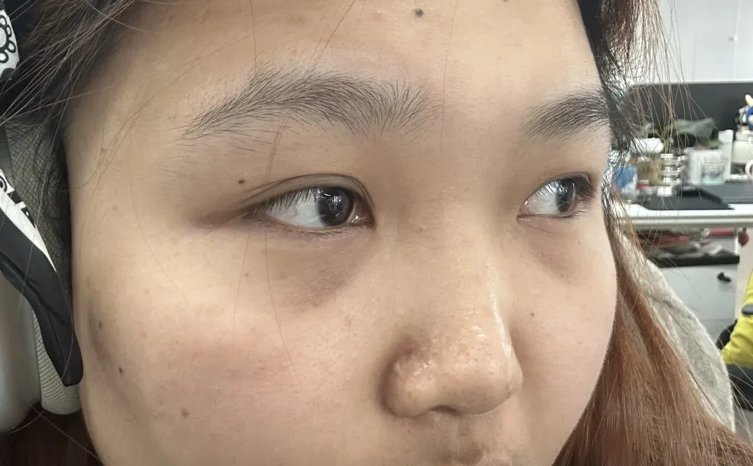 明天就要躺上冰冷冷的手术台了….