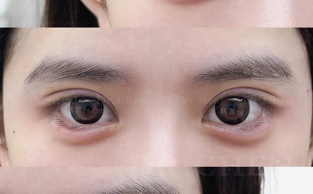 申请成为你的狗狗眼模版❕