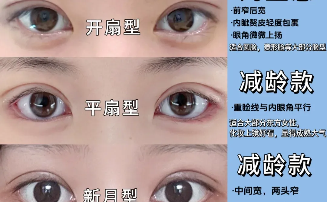 双眼皮形状，五种类型一次说清❗️