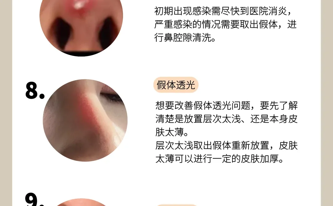 隆鼻失败的姐妹，一定要修复❗️