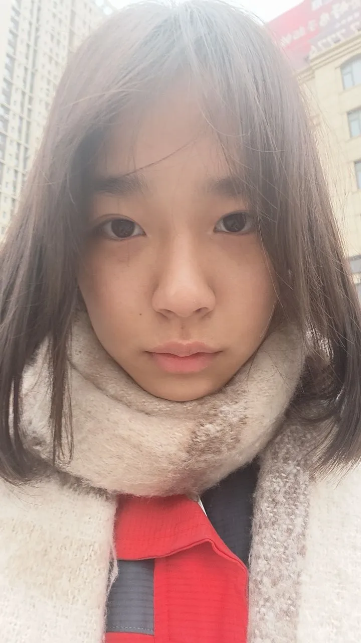 我好焦虑。我真想去整容了