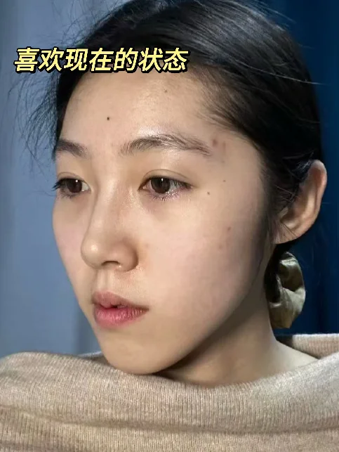 去试了打薄+提升（live版）