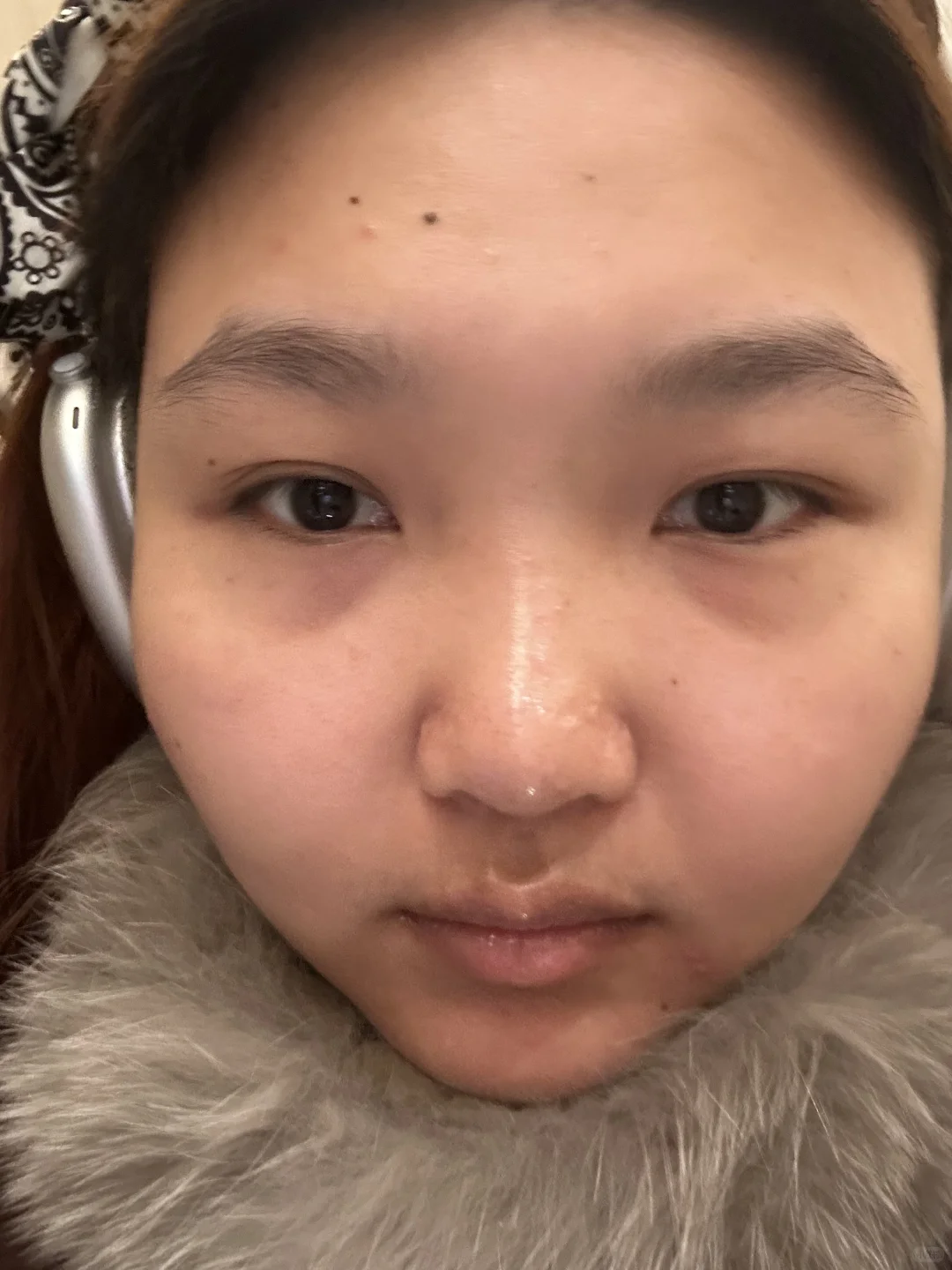 明天就要躺上冰冷冷的手术台了….