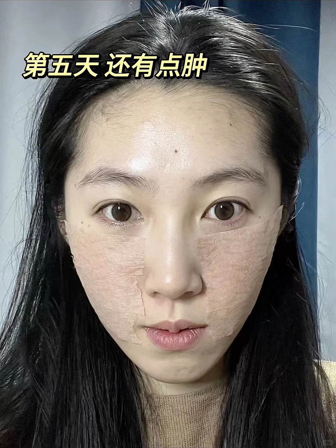 去试了打薄+提升（live版）