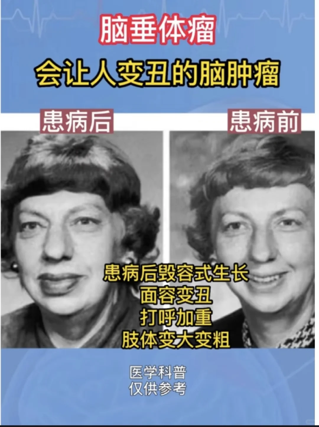 像做了个整容手术