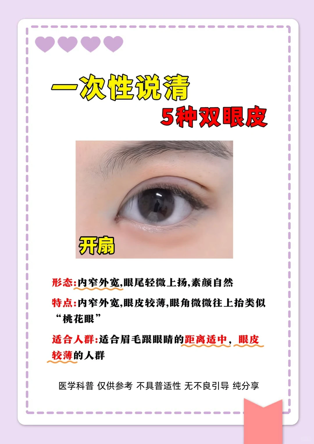 整形主任讲科普，5种双眼皮形态一次性说清楚
