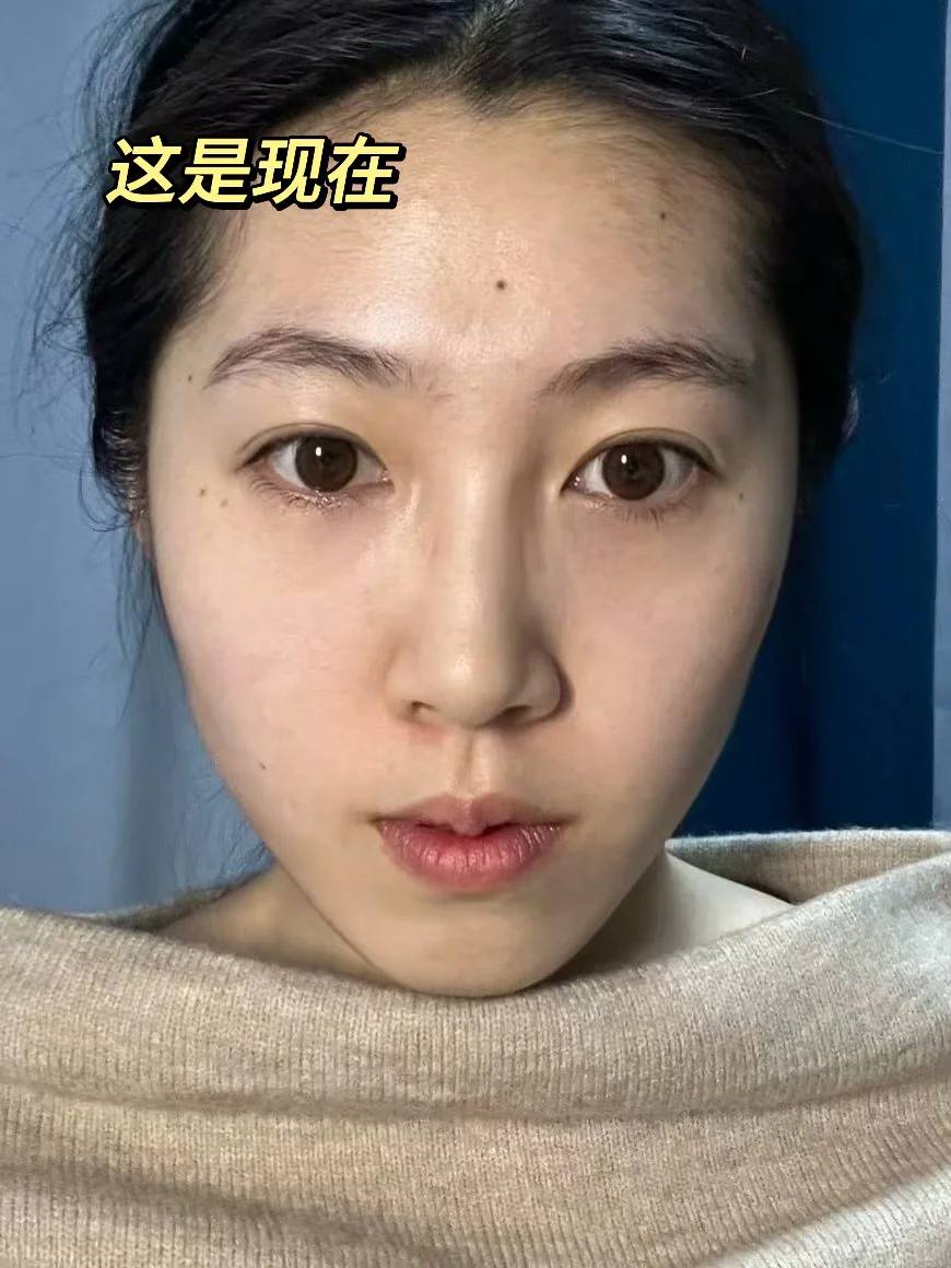 去试了打薄+提升（live版）