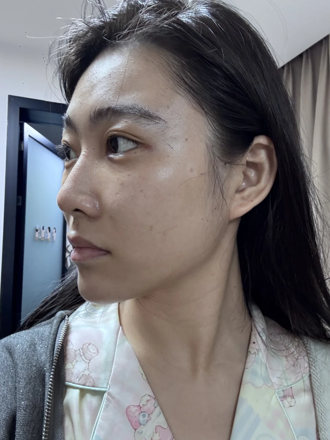 医美do脸对比照来喽