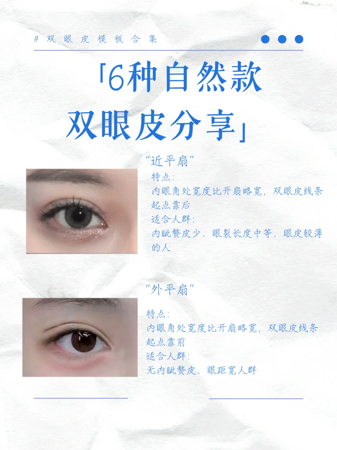 三种常见双眼皮款式细分！