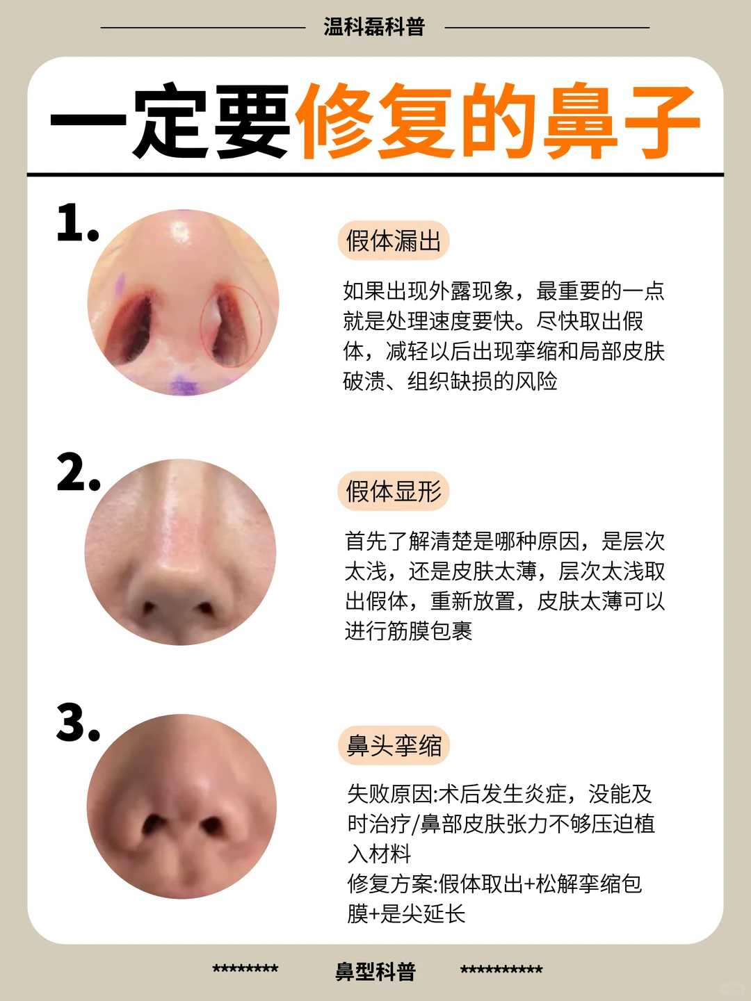 隆鼻失败的姐妹，一定要修复❗️