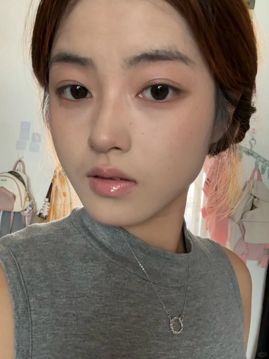 广州鼻子｜3个月现状