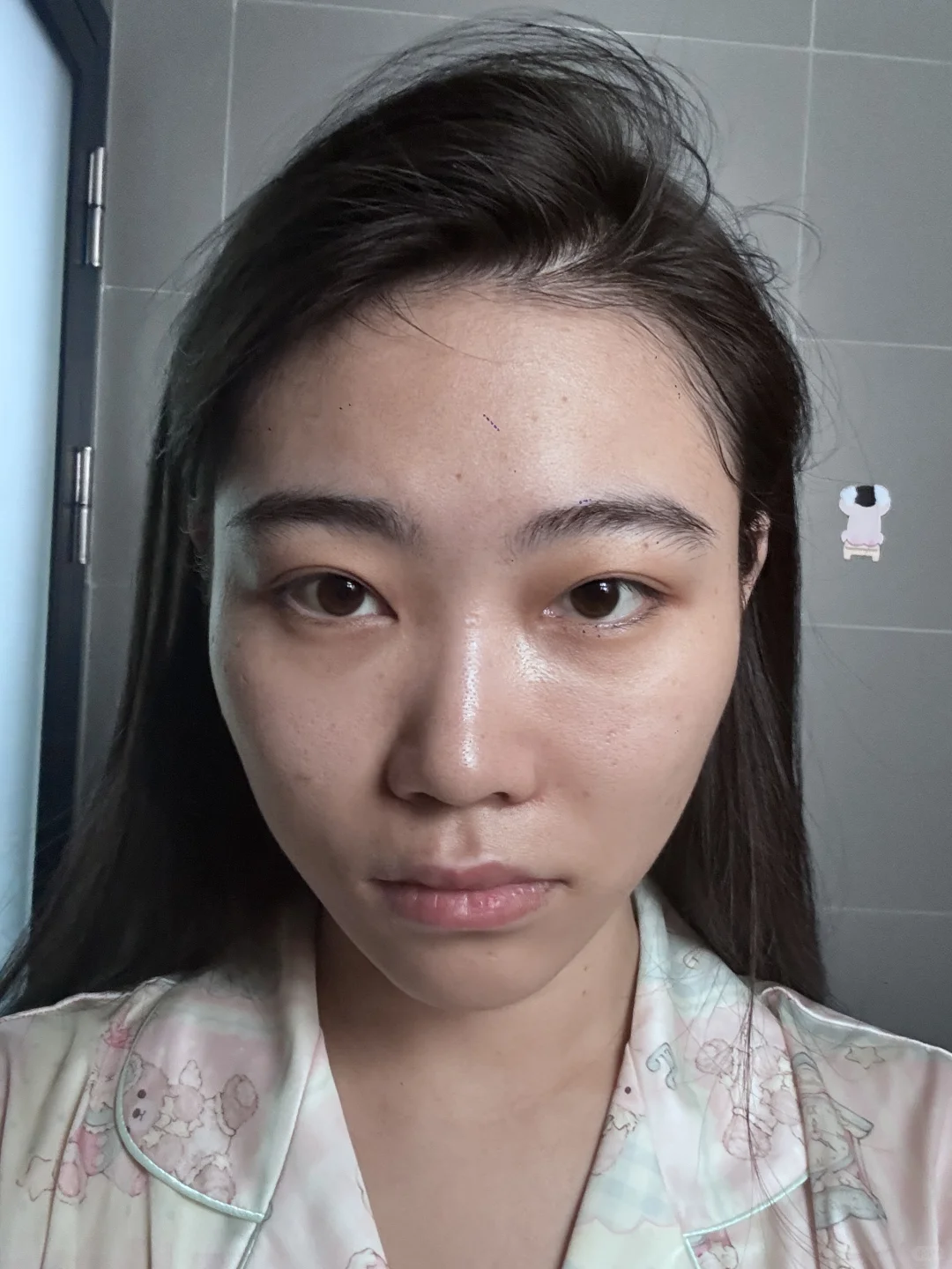 医美do脸对比照来喽