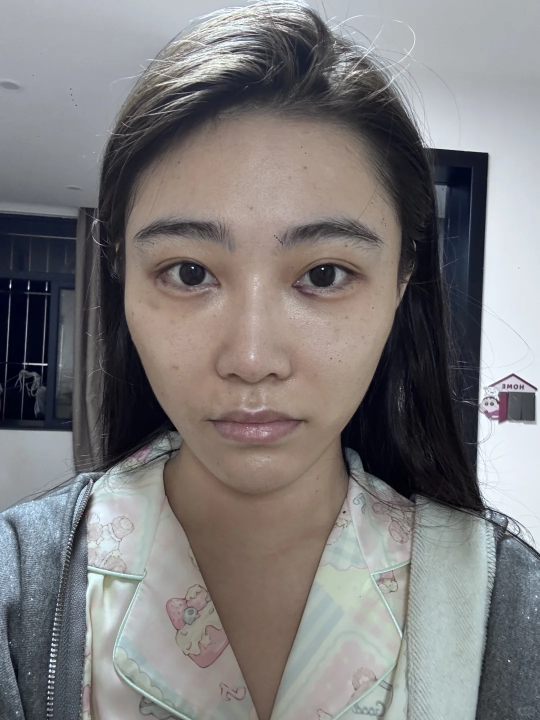 医美do脸对比照来喽