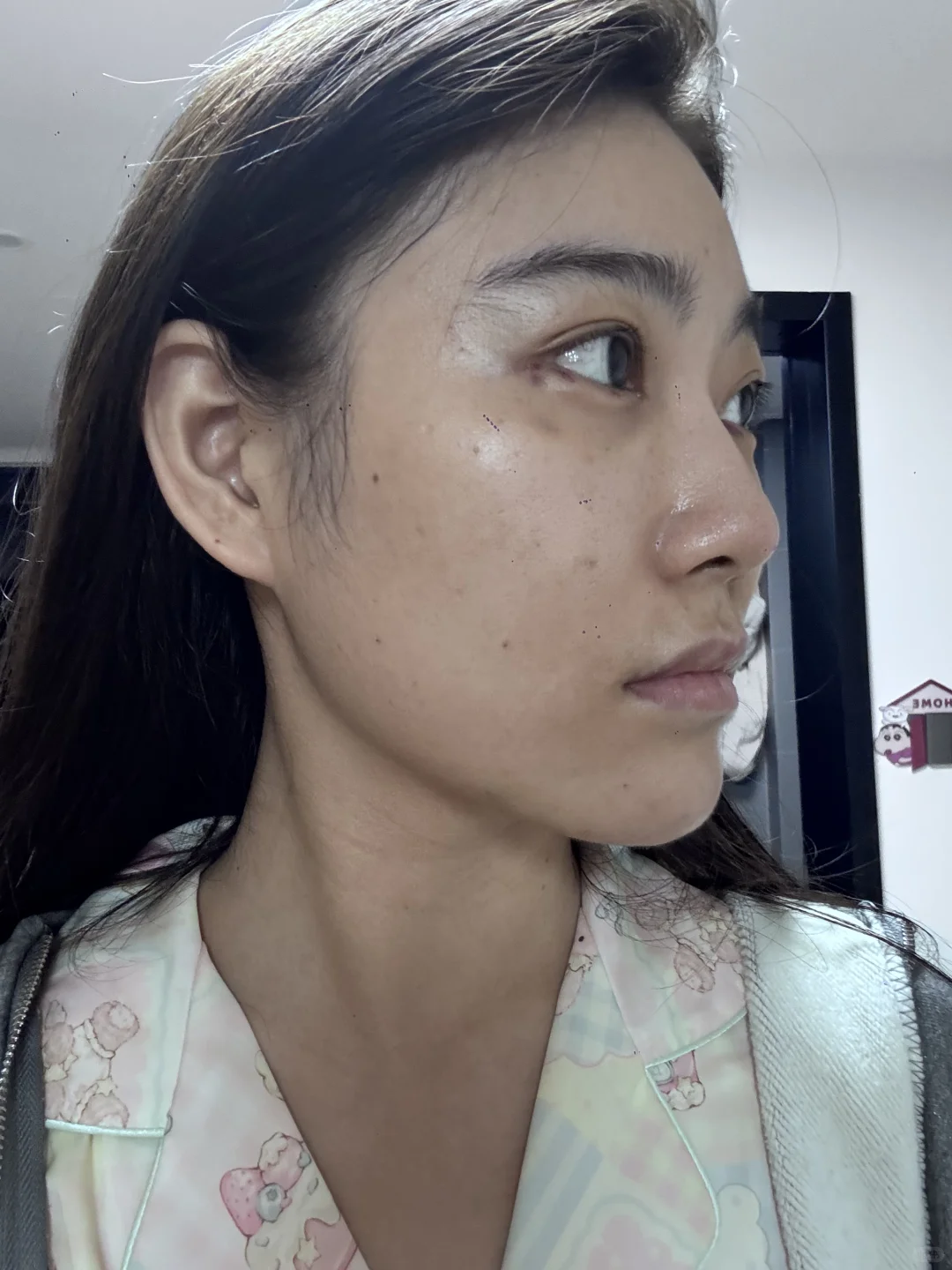 医美do脸对比照来喽