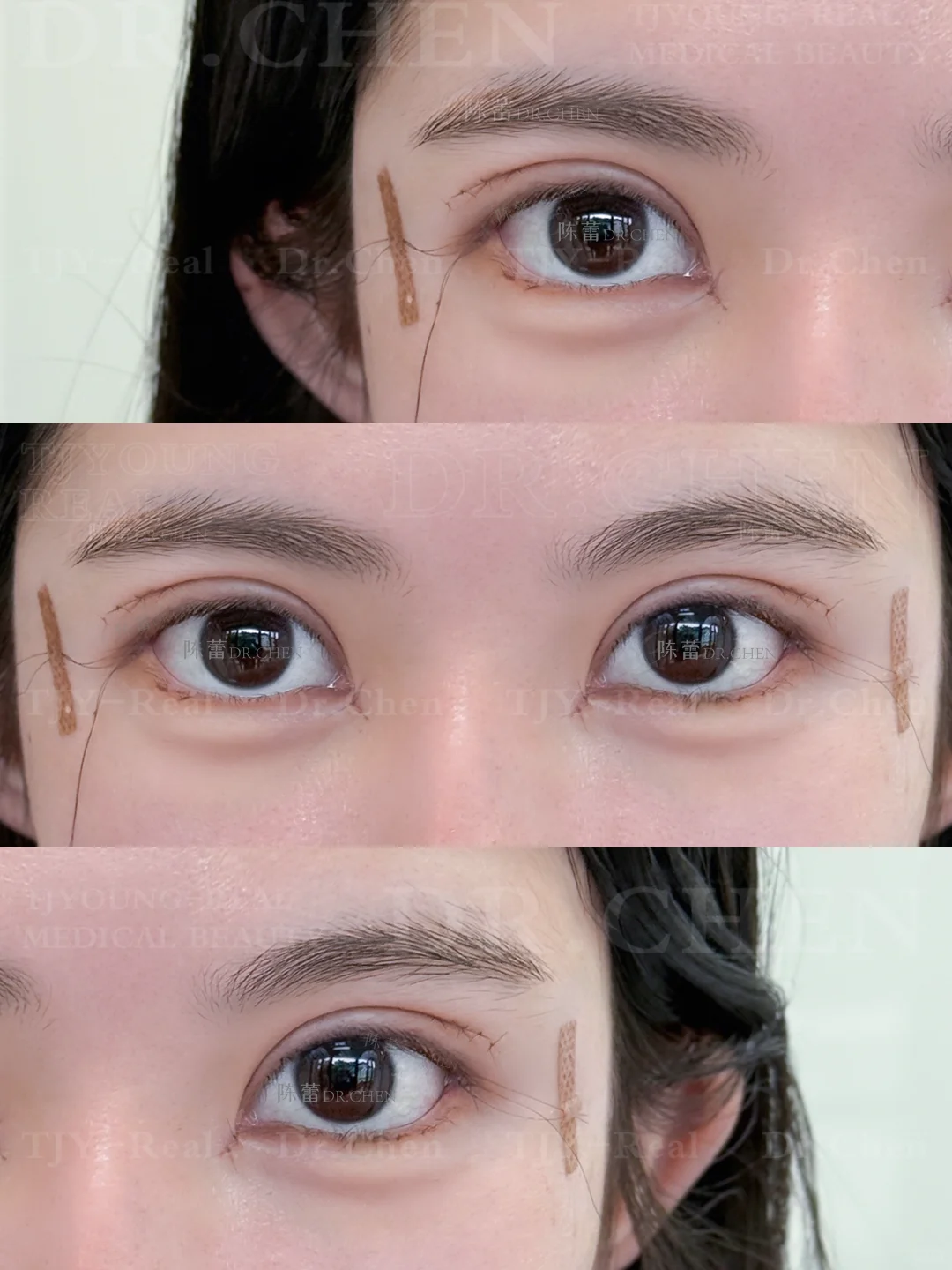 7mm开扇｜漫画少女眼我悟了❕