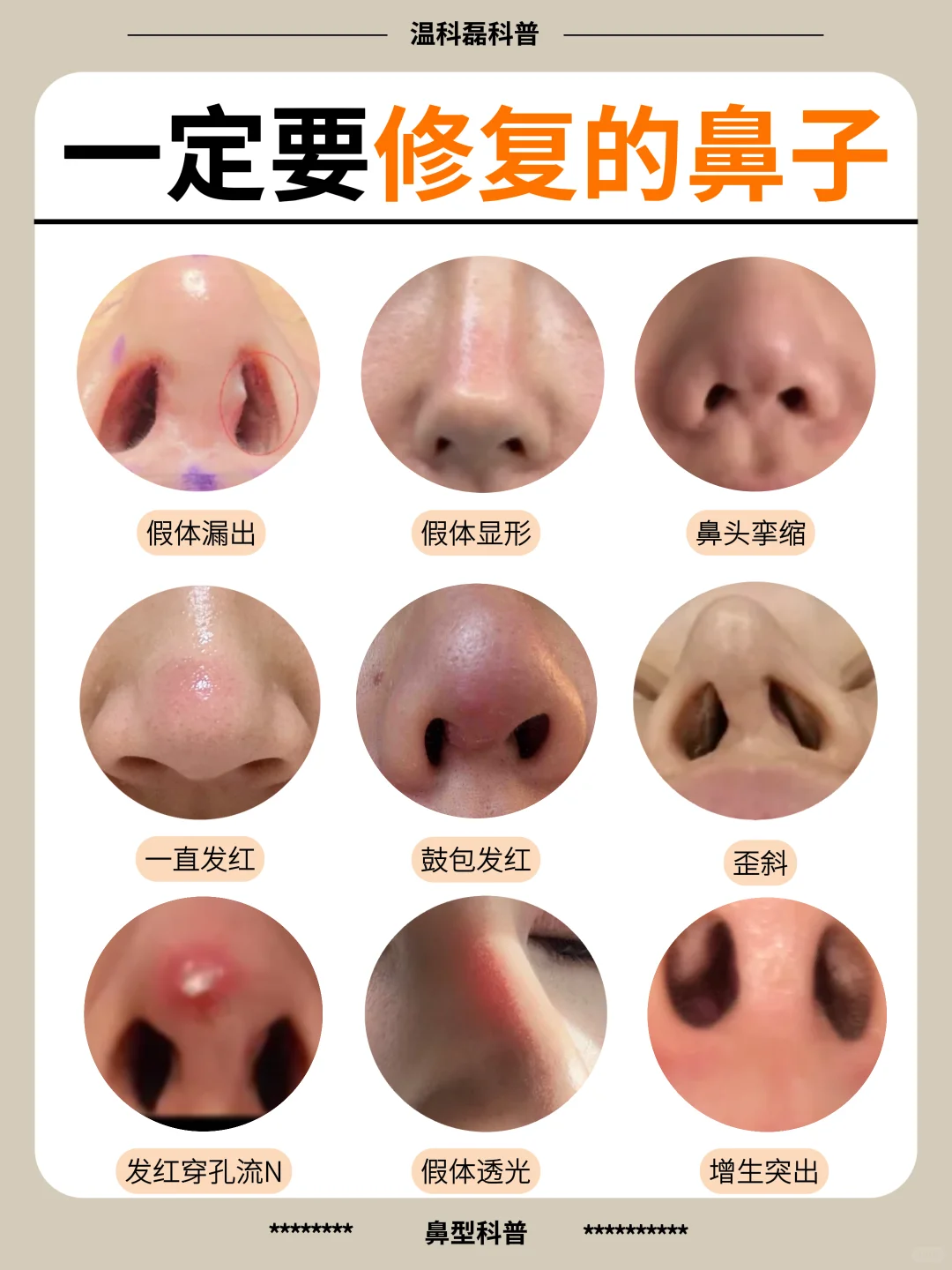 隆鼻失败的姐妹，一定要修复❗️