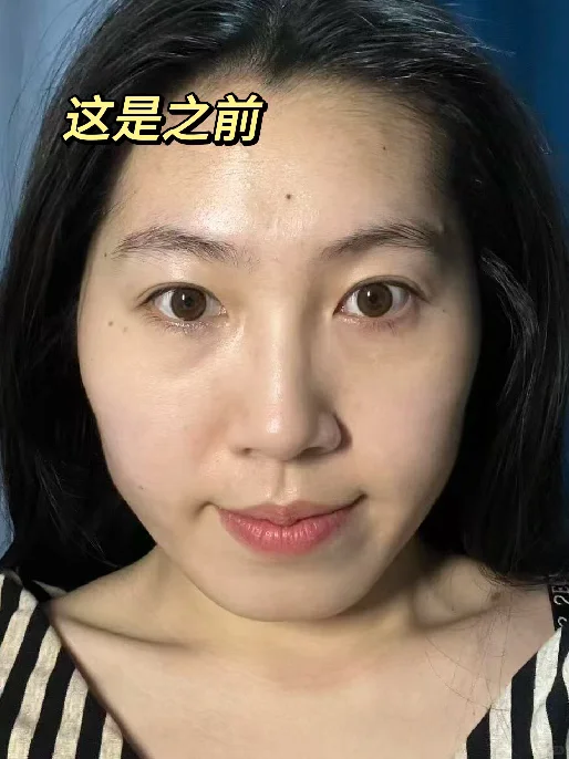 去试了打薄+提升（live版）