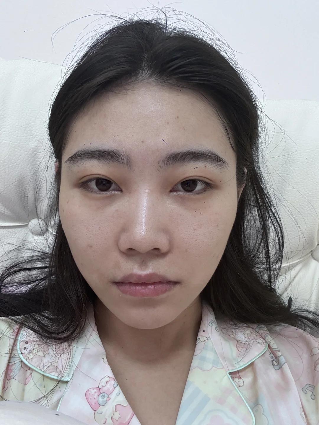 医美do脸对比照来喽