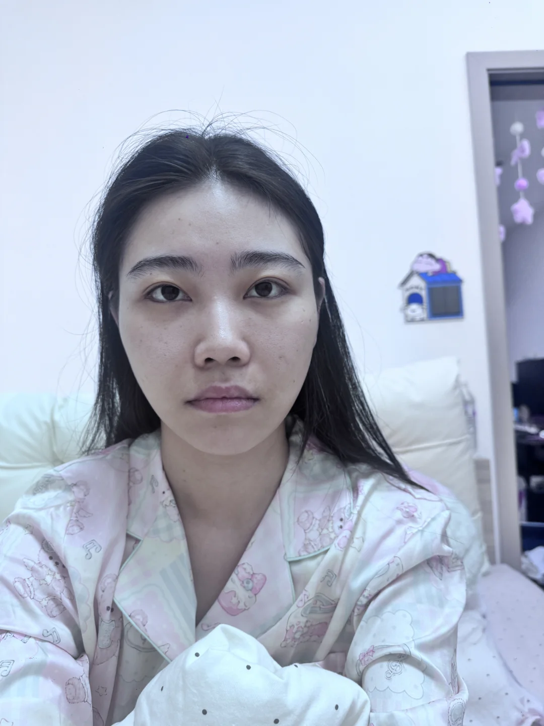 医美do脸对比照来喽