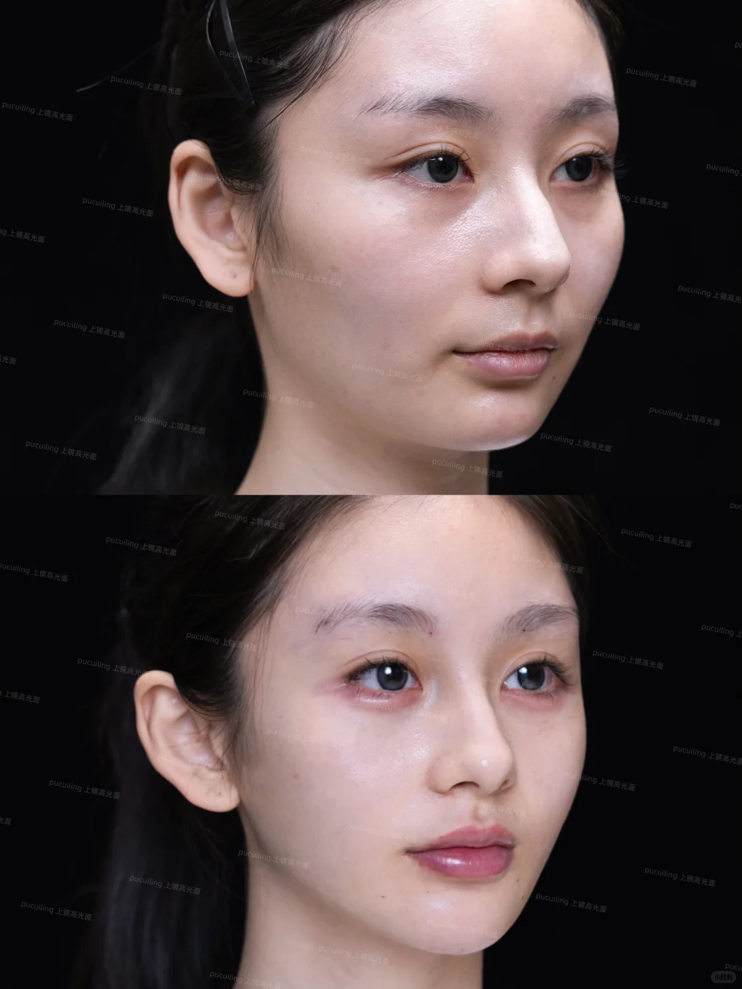 高颧骨+疲态脸|微调逆袭上镜脸