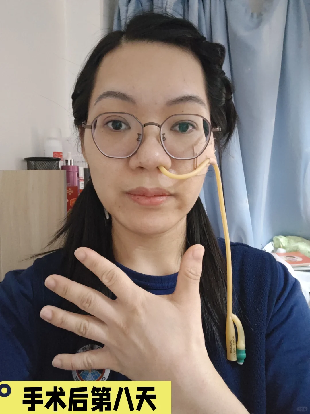 像做了个整容手术