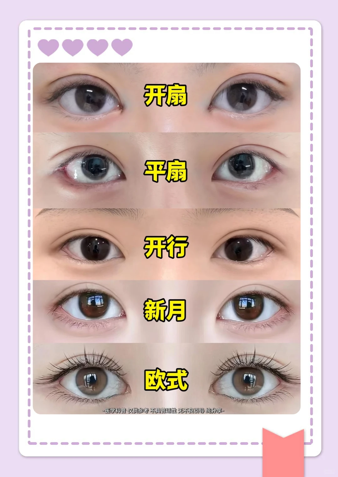 整形主任讲科普，5种双眼皮形态一次性说清楚