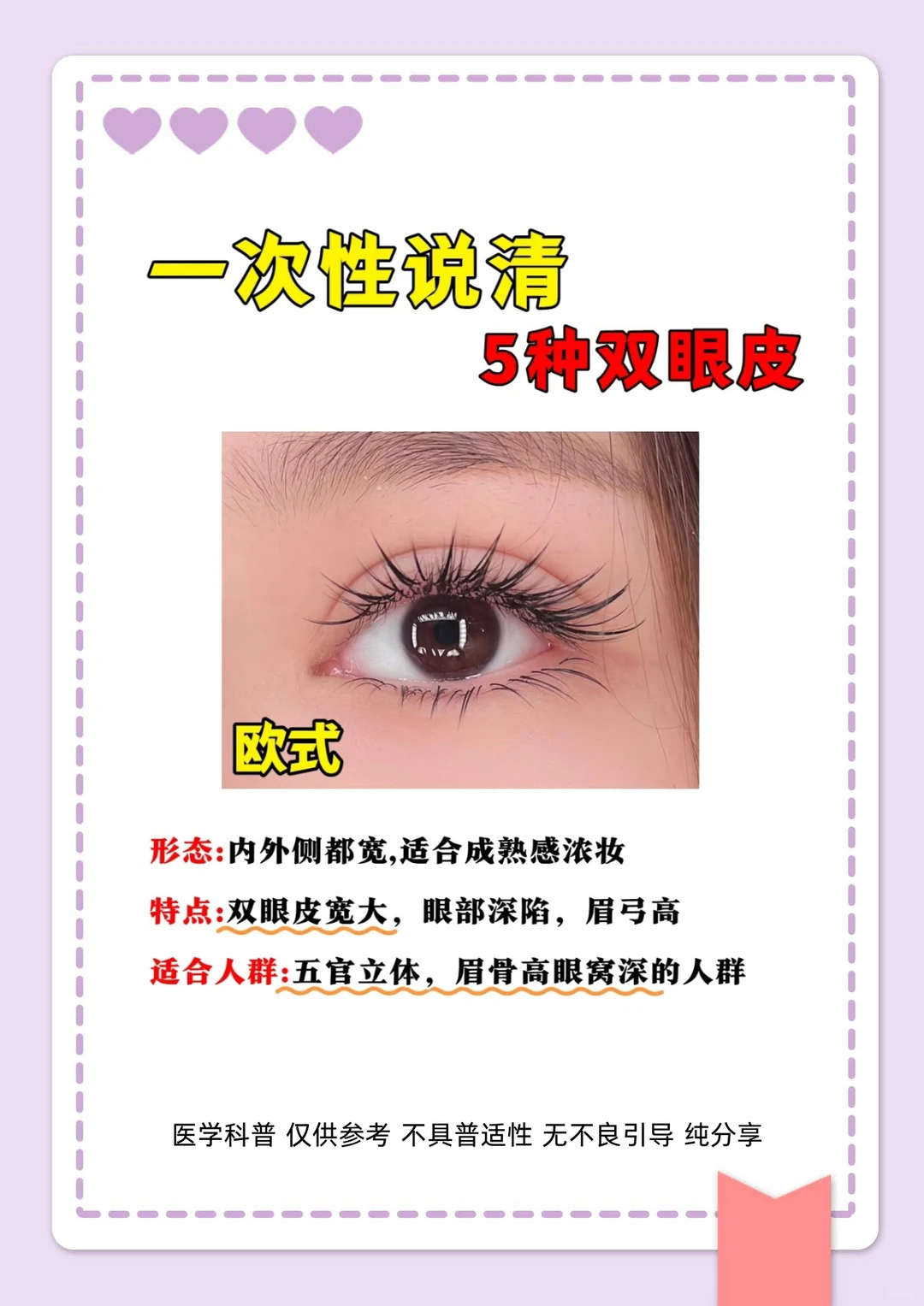 整形主任讲科普，5种双眼皮形态一次性说清楚