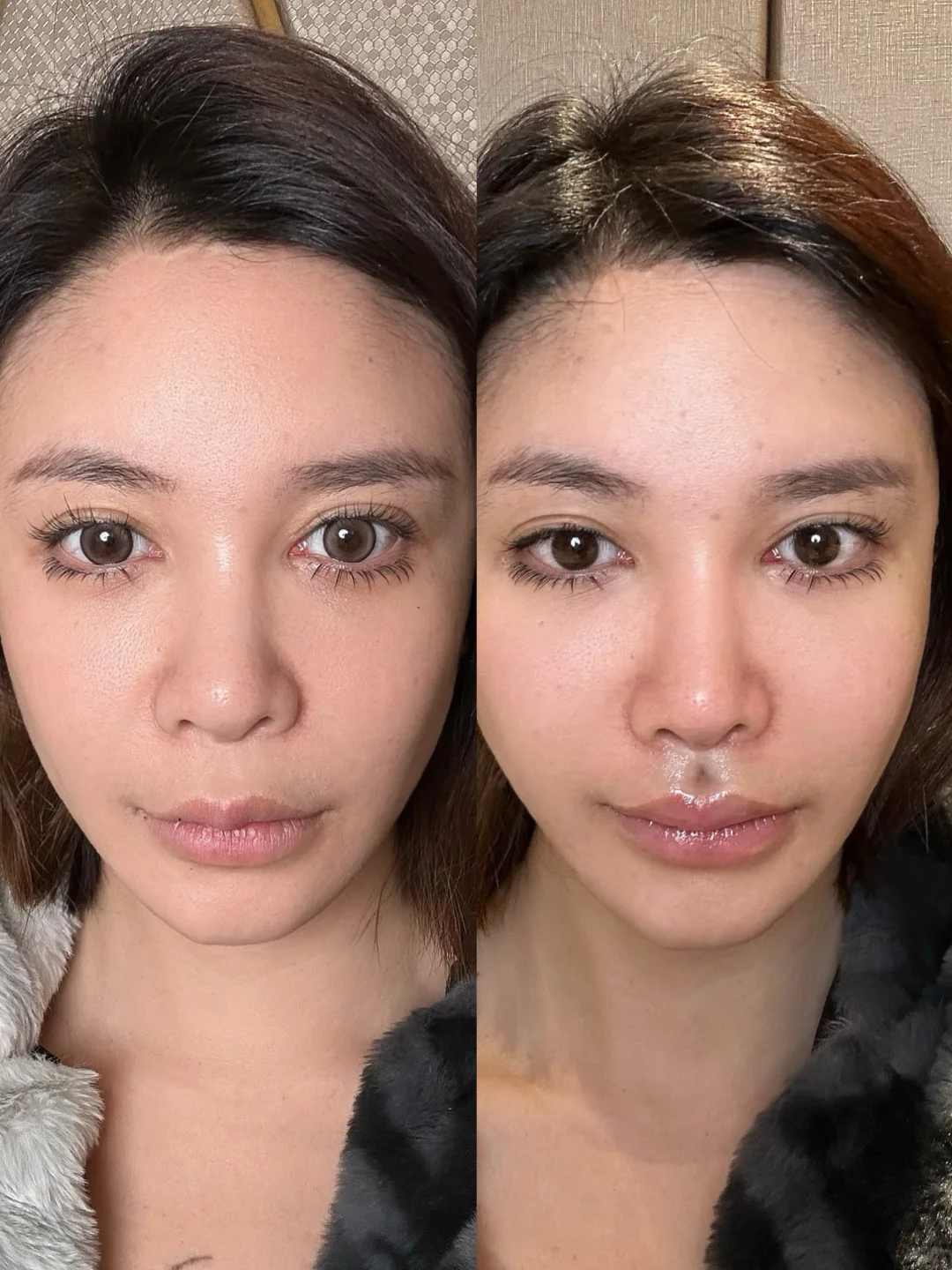 左边还是右边？