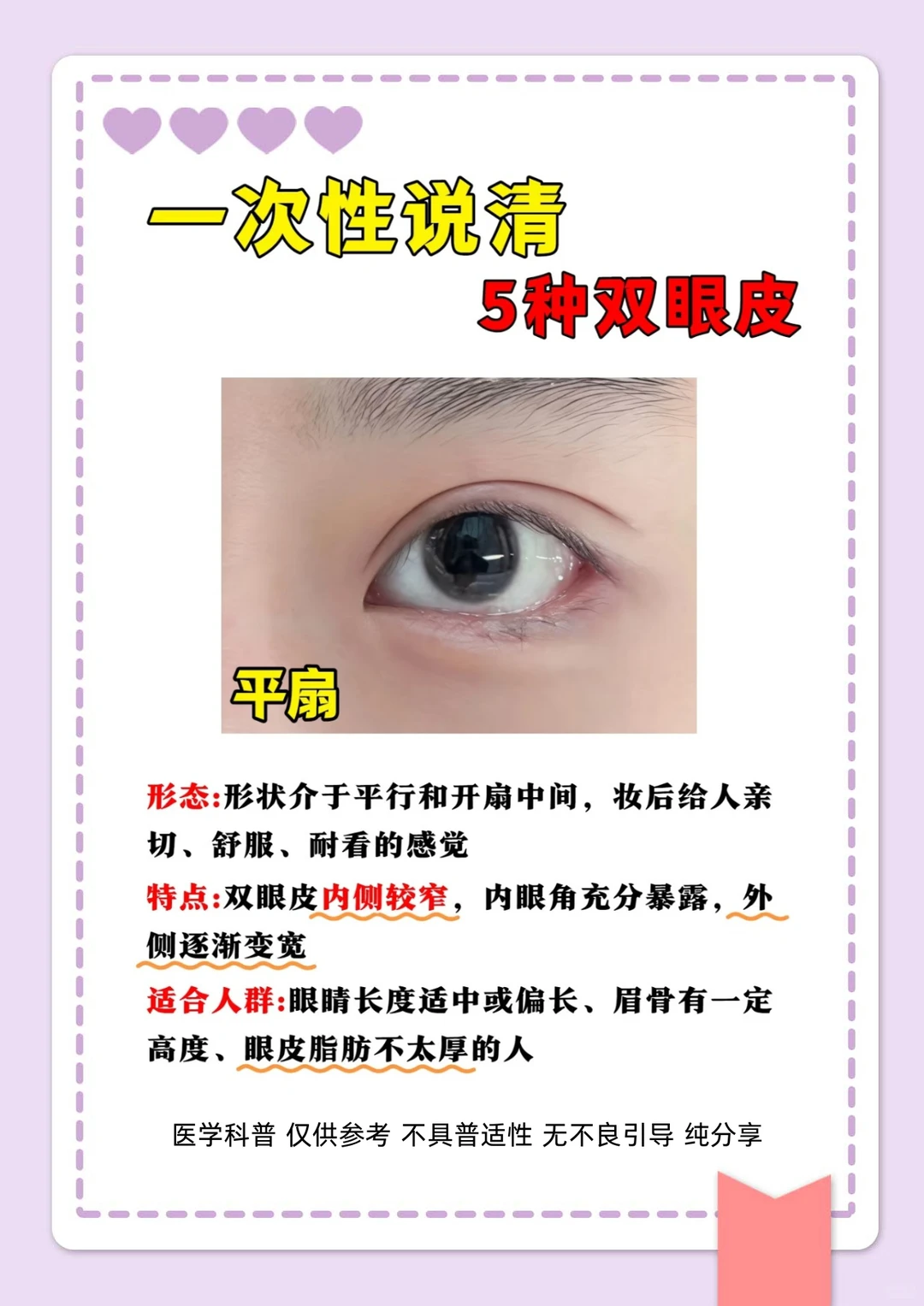 整形主任讲科普，5种双眼皮形态一次性说清楚