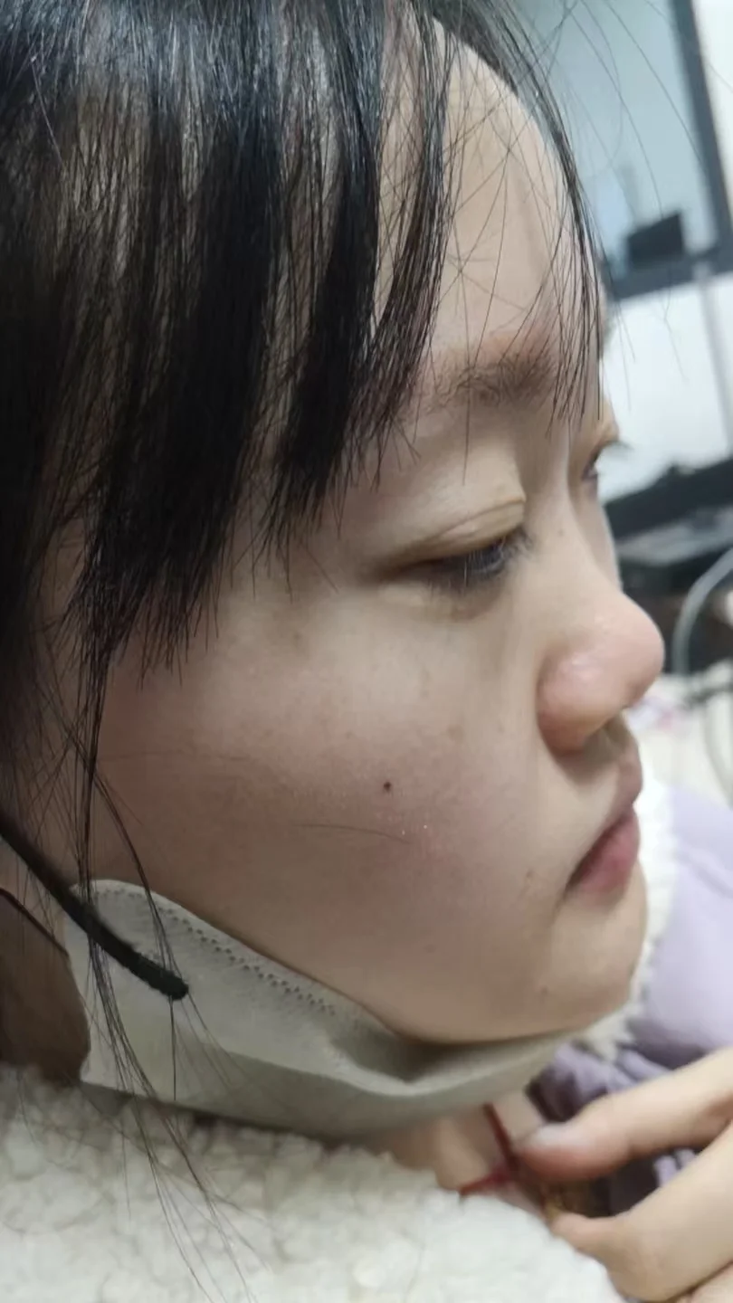 打鼻子👃第4天 我这算还行吧 无痛长个鼻子