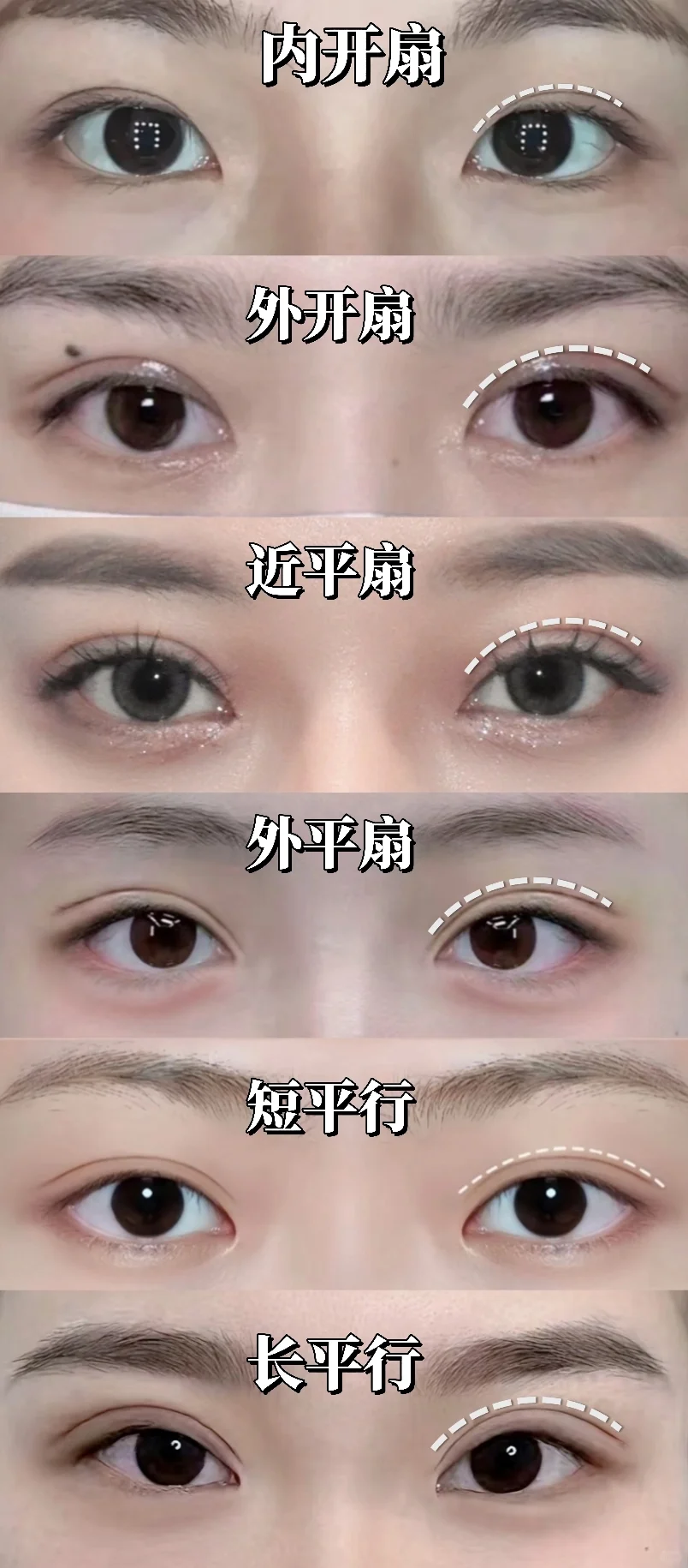 三种常见双眼皮款式细分！