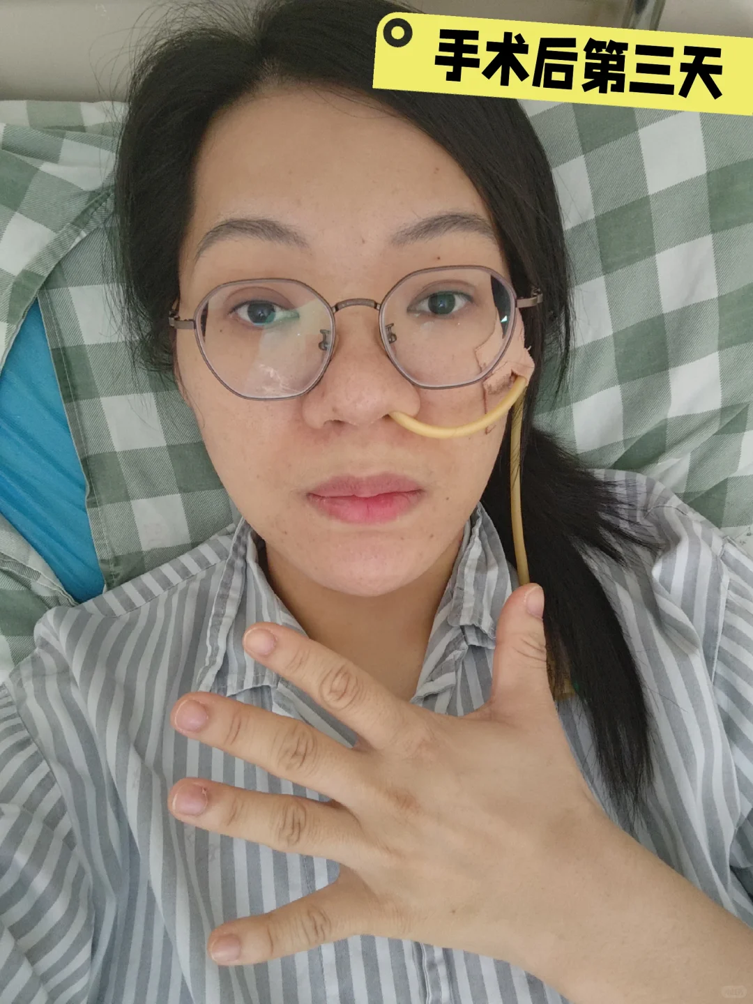 像做了个整容手术