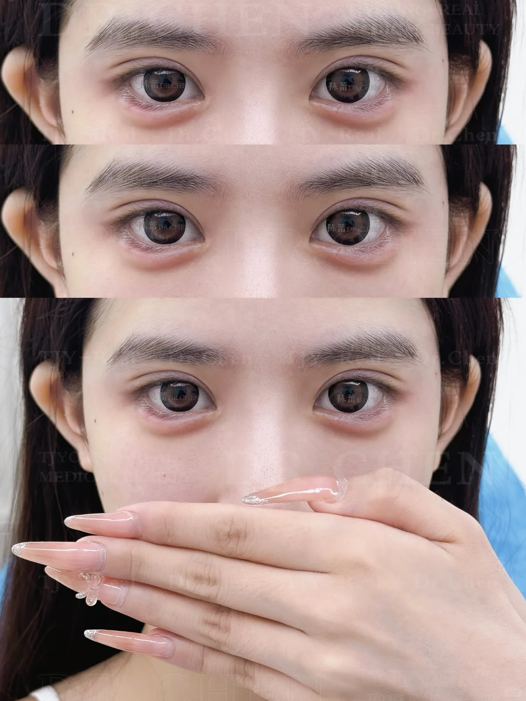 申请成为你的狗狗眼模版❕