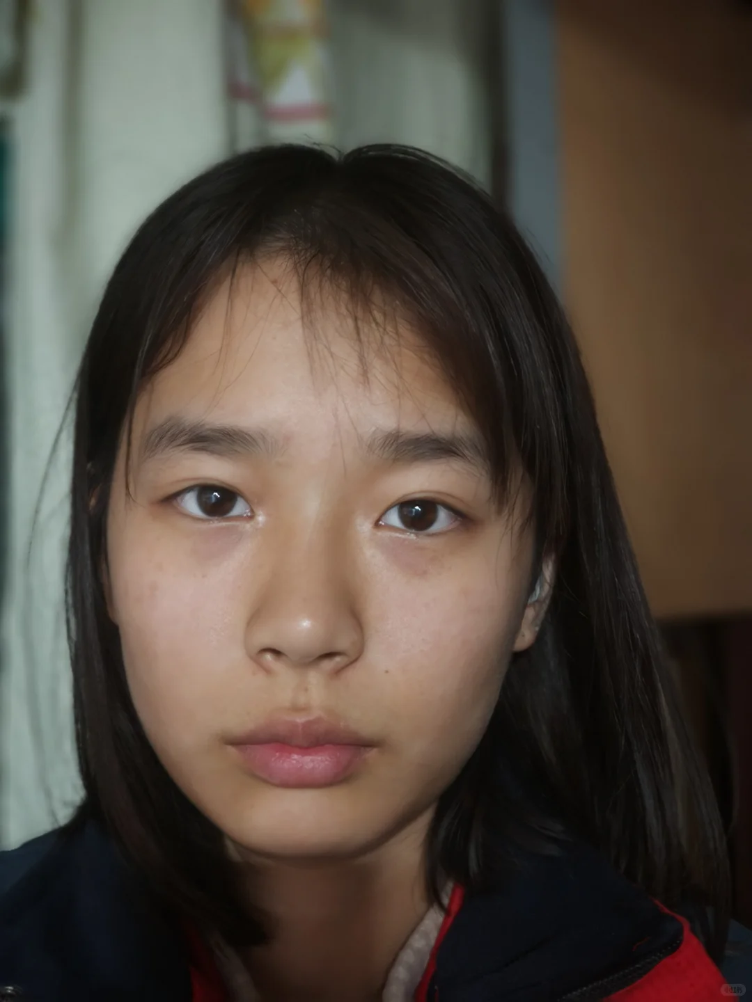 我好焦虑。我真想去整容了