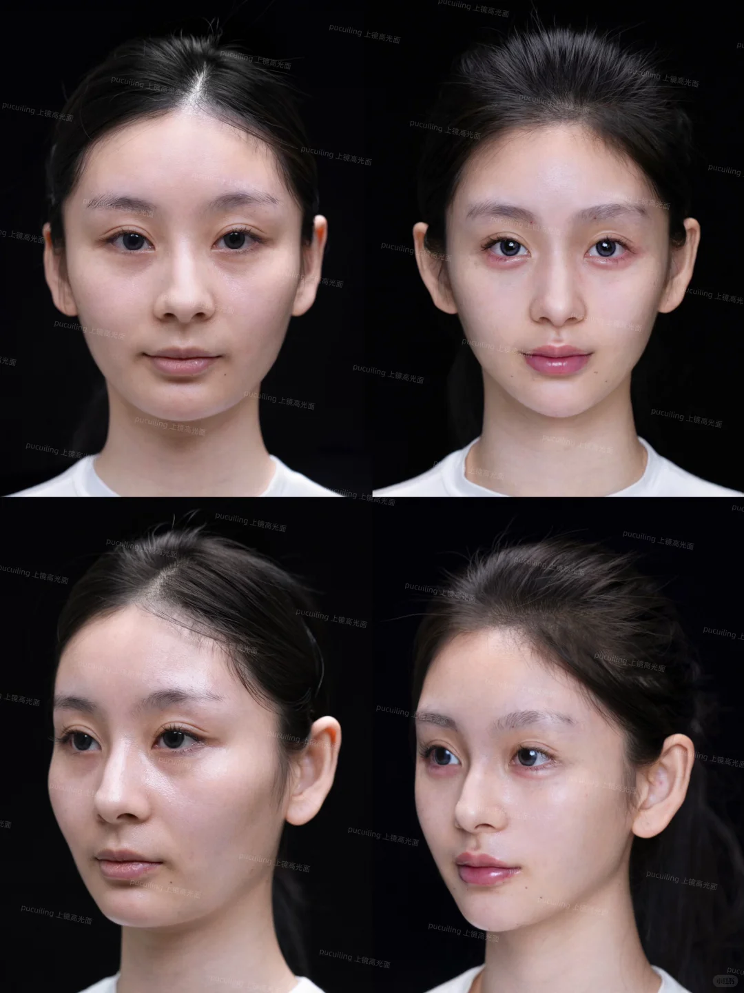 高颧骨+疲态脸|微调逆袭上镜脸